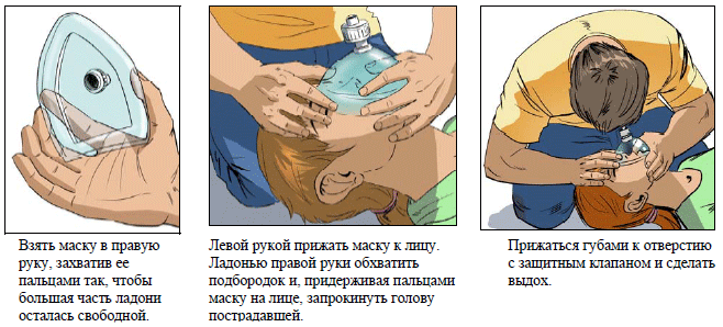 Первая маска первой помощи. Сердечно легочная реанимация с мешком Амбу. ИВЛ С помощью мешка Амбу. Искусственная вентиляция легких мешком Амбу. Карманная реанимационная маска для СЛР.